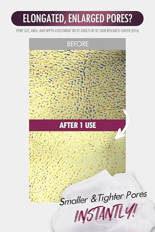 DERMALOGY by NEOGENLAB - NEOGEN PORE TIGHT PEELING MOUSSE 80ml – Mousse Esfoliante para Poros