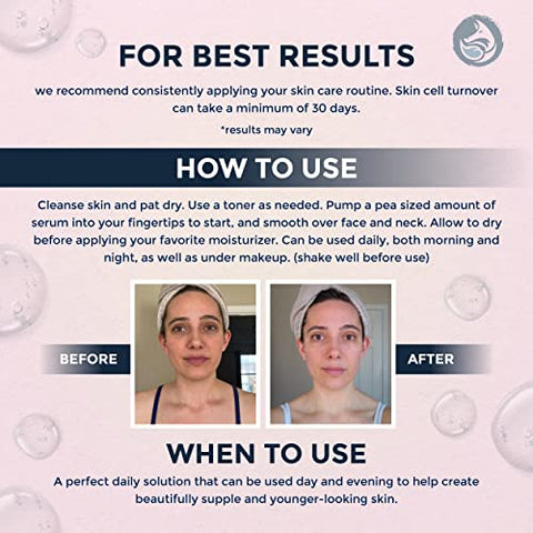 Foxbrim Naturals - Soro Peptídeo de Colágeno para o Rosto – Soro Facial Anti-Envelhecimento, Firmeza, Levantamento e Hidratação