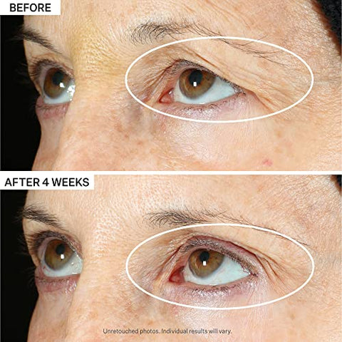 Tighten: Creme Reafirmante Facial 50g – Resultados Visíveis - StriVectin