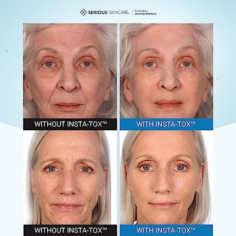 INSTA-TOX – Soro Facial Instantâneo para Suavizar Rugas – Melhora a Aparência de Linhas Finas – 30g - Serious Skincare