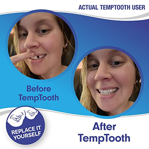Produto Patenteado de Substituição Temporária de Dente, Confiança do Número 1 em Vendas - Temptooth