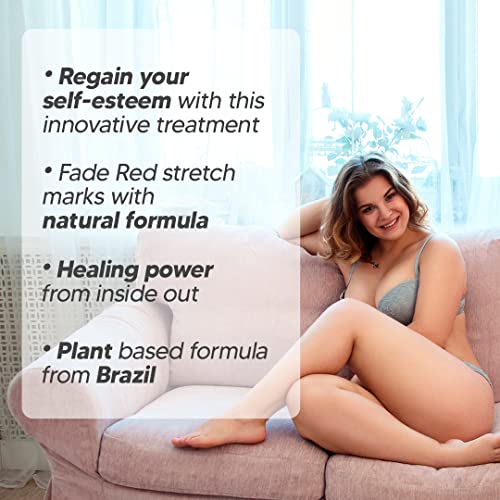 Red – Fórmula Inovadora para Remoção de Estrias Vermelhas e Roxas – Ingredientes Naturais Poderosos da Flora Brasileira – Para Todos os Tipos de Pele - Cicatrissim
