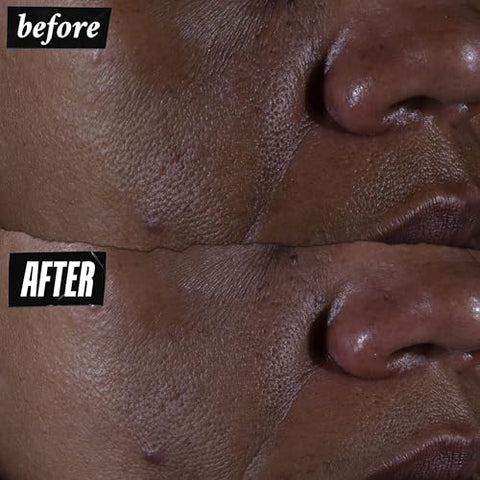 Kiehl’s Serum Facial Concentrado de Ácido Glicólico 9.8% Ultra Puro – Esfoliante para Pele Radiante e Textura Suavizada – 30ml