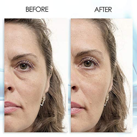 Gel para Olhos Inchados – Resultados Instantâneos – Redução Rápida e Natural – Elimine Rugas, Inchaço e Bolsas – Gel Hidratante para Olhos com Extrato de Chá Verde por Aqua Mineral – 30ml