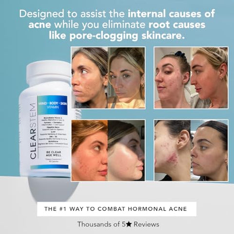 CLEARstem - CLEARSTEM – MINDBODYSKIN Suplemento para Acne Hormonal (5-HTP) – DIM Natural – Vitaminas para Cuidados com a Pele – Equilíbrio Hormonal, Antioxidantes – Vegano, Sem Glúten, Cruelty Free – 30g