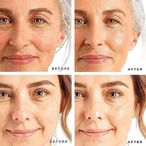 Tree of Life Beauty - Sérum Firmador de Retinol e Ácido Hialurônico Tree of Life, Duo de Sérum Facial para Brilho, 2 Unidades x 60 ml – Kit de Cuidados com a Pele