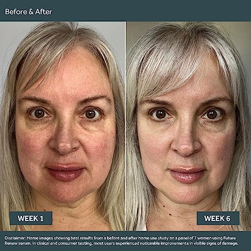 Future Renew Damage Reversal Face Serum – Soro Facial de Peptídeo de Absorção Rápida para Reduzir Visivelmente Linhas Finas – 30ml - No7