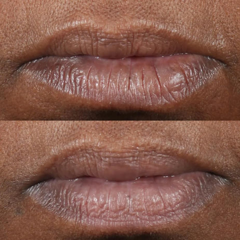 Perricone MD Lip Therapy Cold Plasma Plus | Nutritivo | 15g