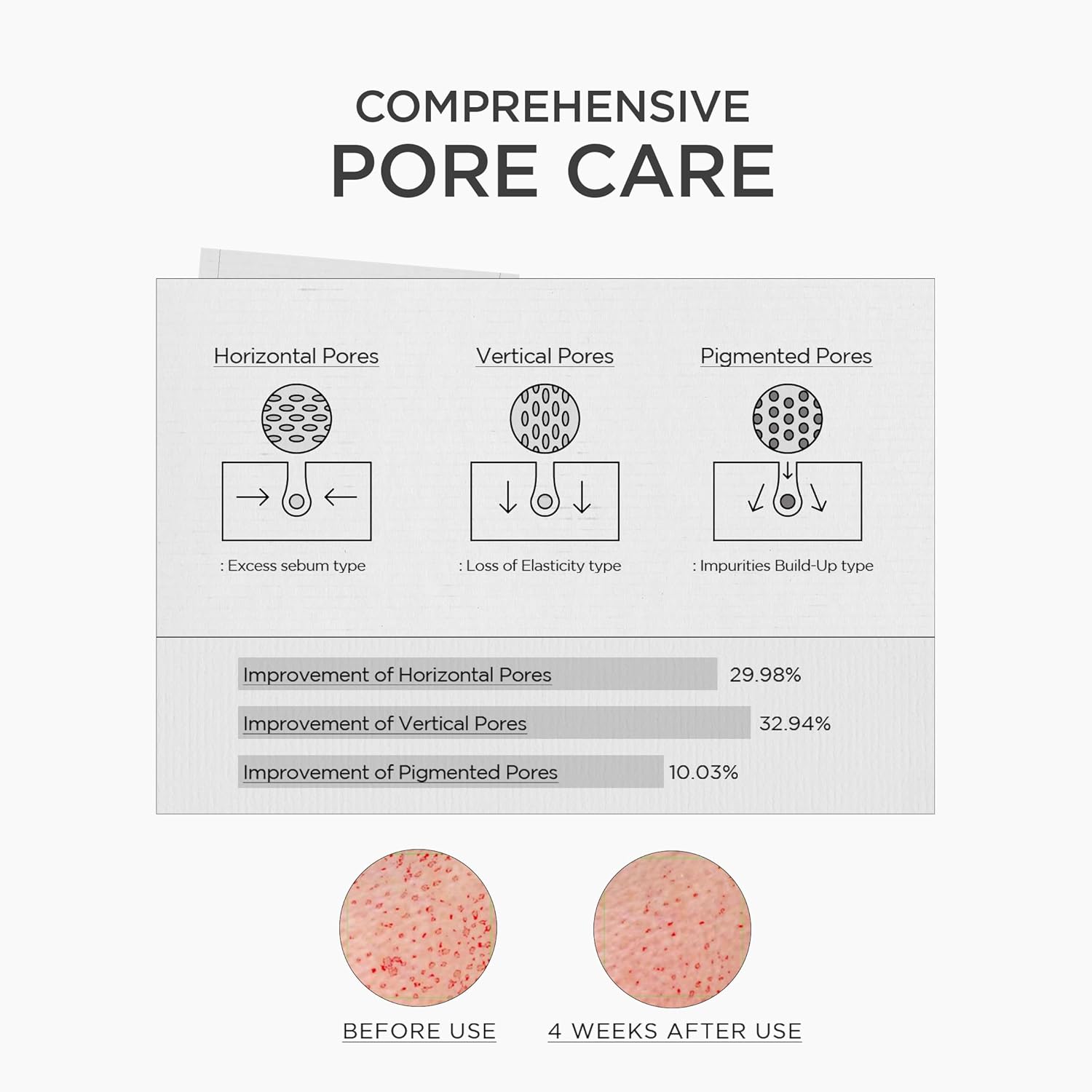 SKIN1004 Niacinamide 10% Boosting Shot Ampoule, Niacinamide Spicule Serum for Face, Facial Ampoule with Tranexamic Acid, Pore Minimizer for Face, Madagascar Centella, Korean Skin Care, 1.01fl.oz/ 30ml