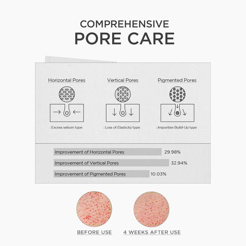 SKIN1004 Niacinamide 10% Boosting Shot Ampoule, Niacinamide Spicule Serum for Face, Facial Ampoule with Tranexamic Acid, Pore Minimizer for Face, Madagascar Centella, Korean Skin Care, 1.01fl.oz/ 30ml