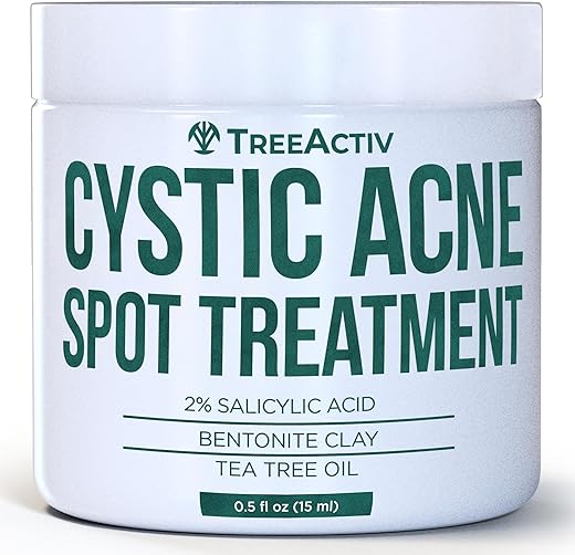 Tratamento para Acne Cística TreeActiv – Ácido Salicílico, Creme para Acne Facial, Tratamento para Acne Hormonal, Creme para Acne Facial e Corporal, Tratamento para Manchas de Acne